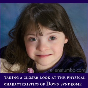 physical characteristics of Down syndrome