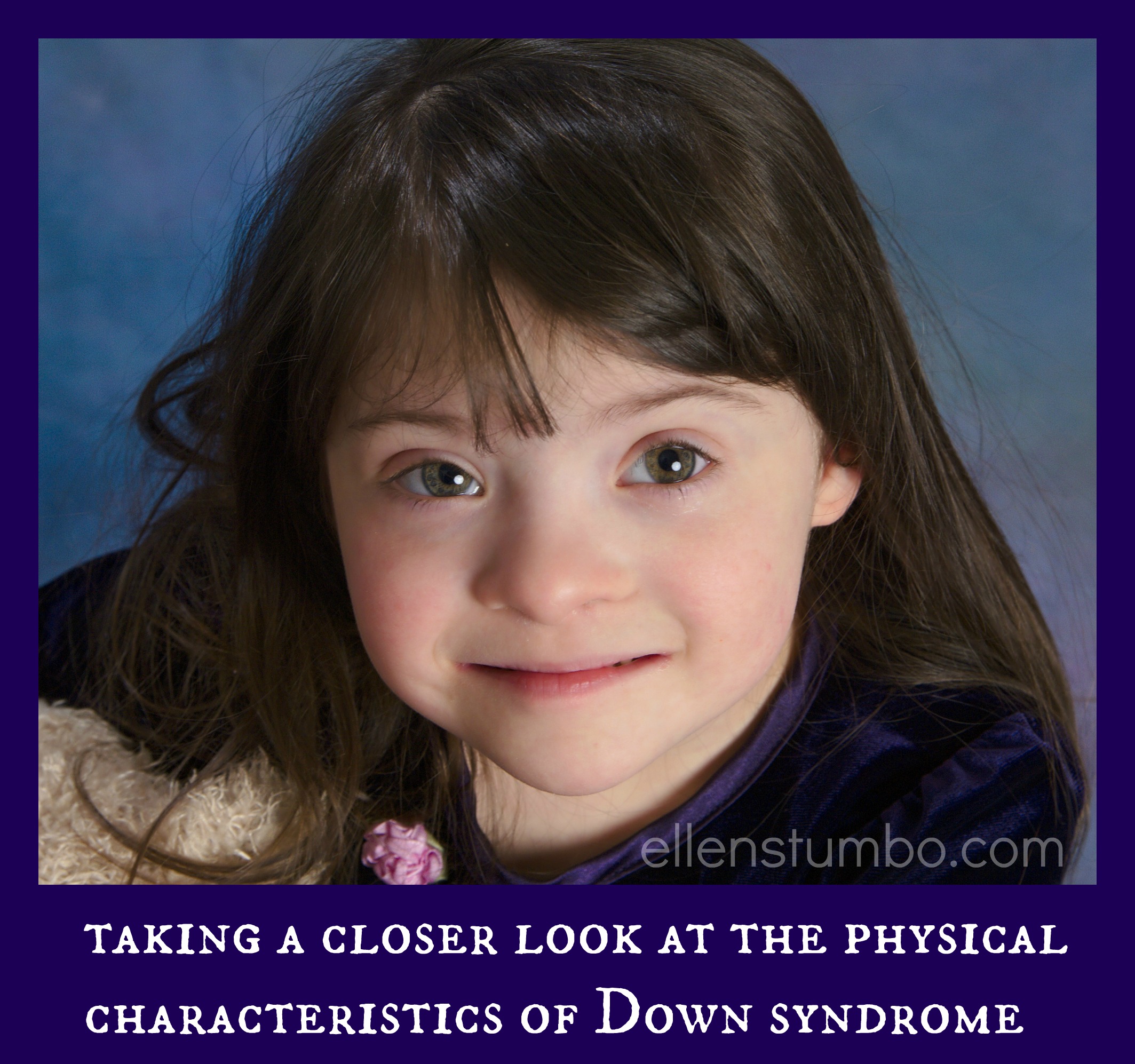 A Closer Look At The Physical Characteristics Of Down Syndrome Ellen 