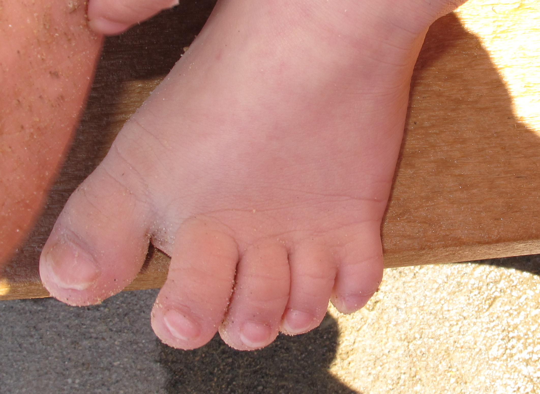 A Closer Look At The Physical Characteristics Of Down Syndrome
